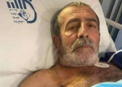 محمود صالحی عمل پیوند رگ edited