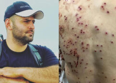 مهاباد؛ آرمان جوادیان از مجروحان قیام ژینا، تحت فشار نیروهای رژیم از ایران خارج شد