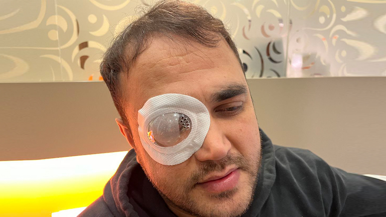 آلمان؛ جراحی دوباره فیروز میرانی از آسیب‌دیدگان خیزش ژینا