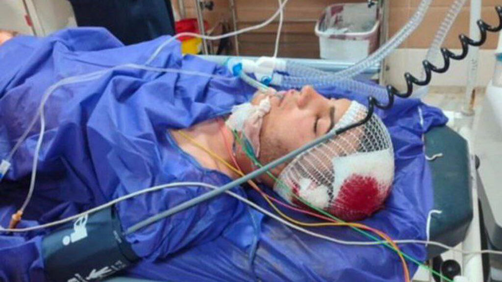 رضا مرادی از مجروحان خیزش مردمی در ازنا، جانباخت